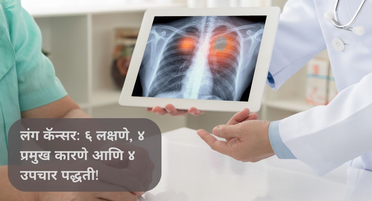 लंग कॅन्सर